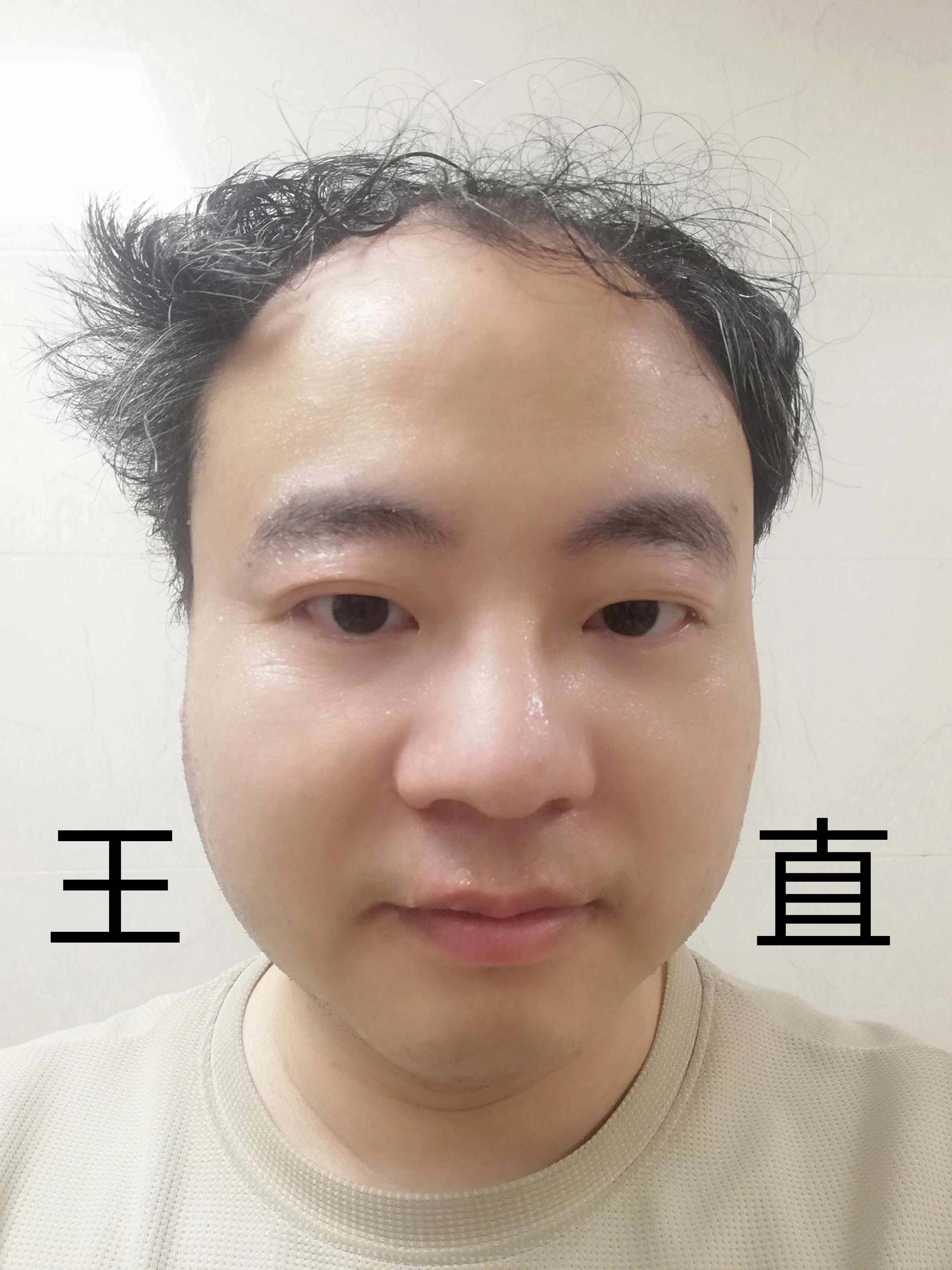 王直